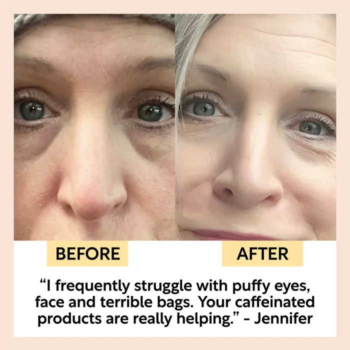 UpCircle Beauty Eye Cream with Hyaluronic Acid + Coffee before and after comparison