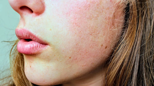Blonde woman with red cheeks