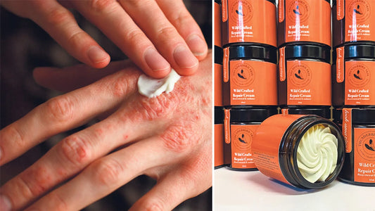 Images of Thunderbird Skin cream and how it helps for blog
