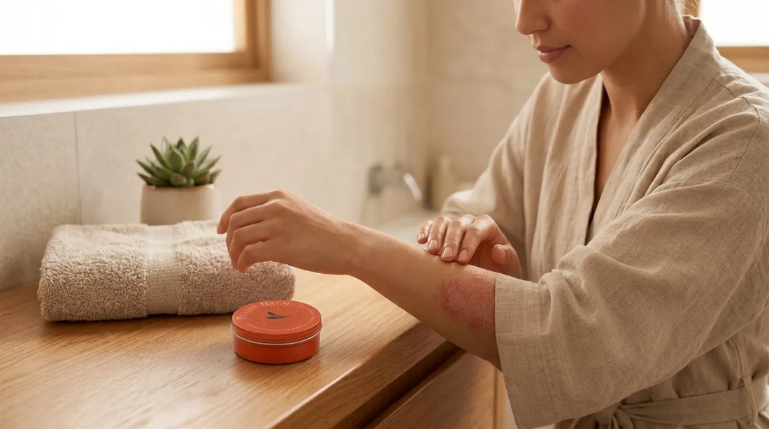 Woman with eczema in robe in bathrooms with Thunderbird Rescue Balm on table