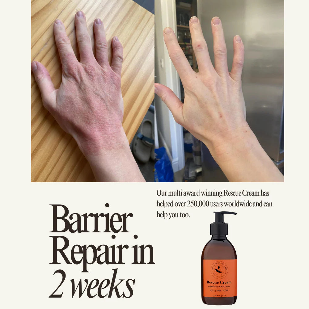 Thunderbird Rescue Cream before and after on hand and wrist