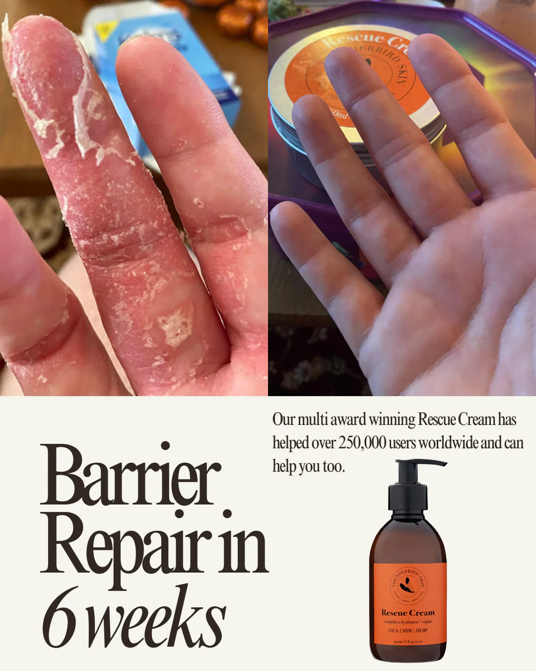 Thunderbird Rescue Cream on fingers before and after