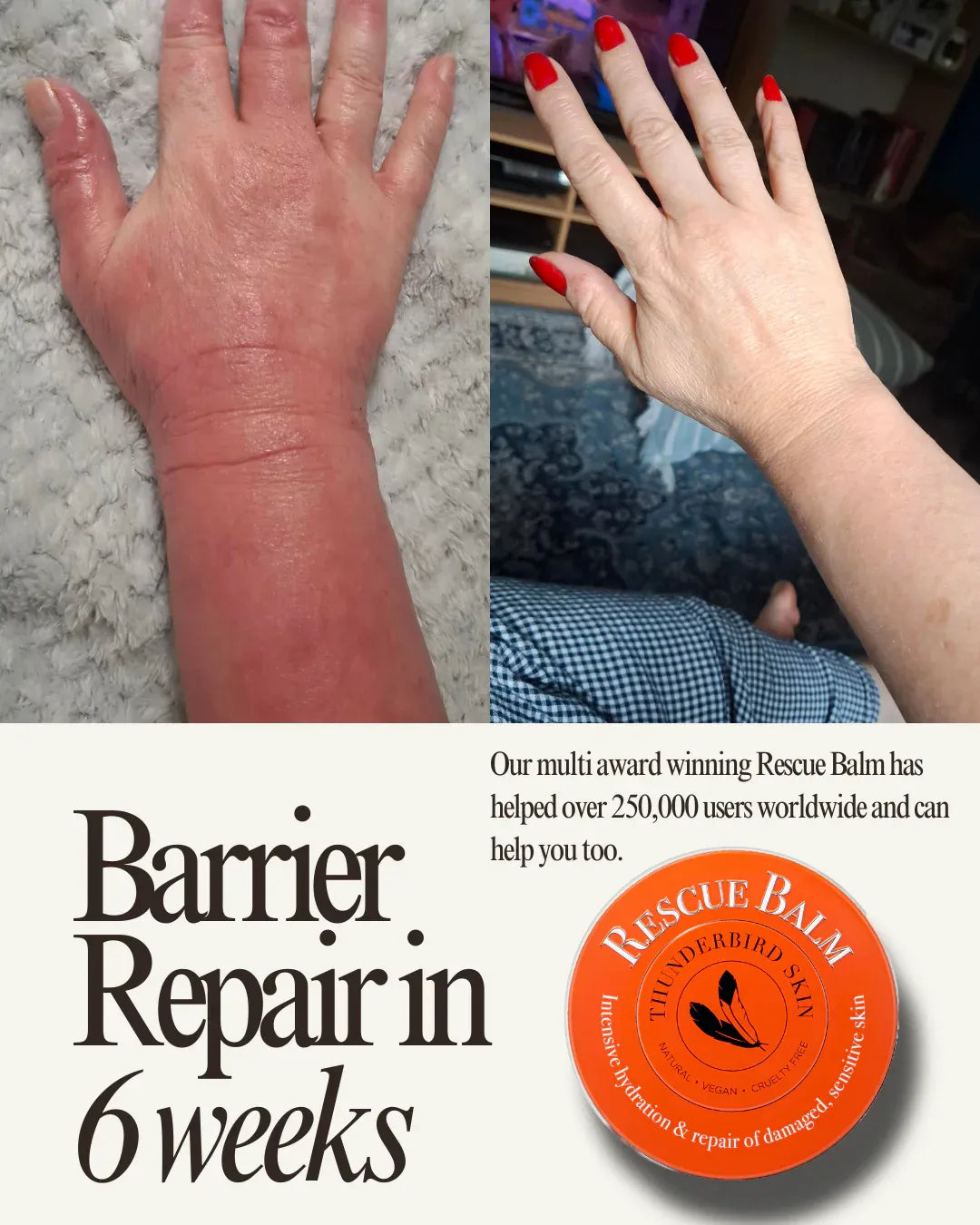 Before and after comparison of a hand with dry skin using Rescue Balm, featuring the brand logo.