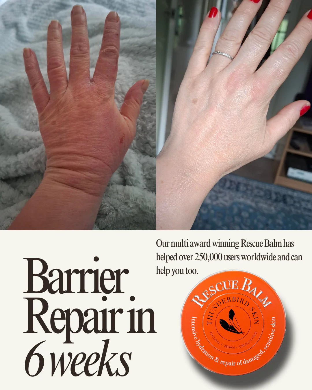 Before and after of rescue balm