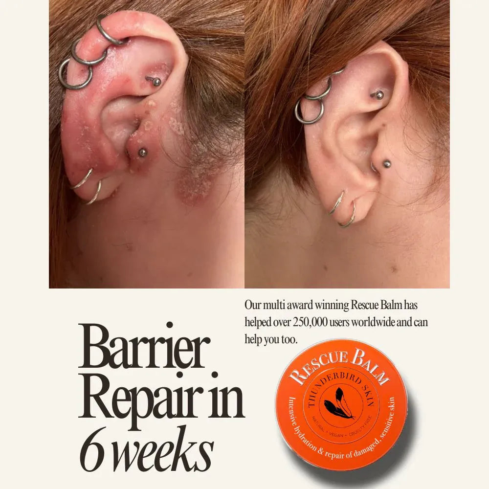 Before and after comparison of ear with healed skin and visible earrings, featuring Rescue Balm advertisement.