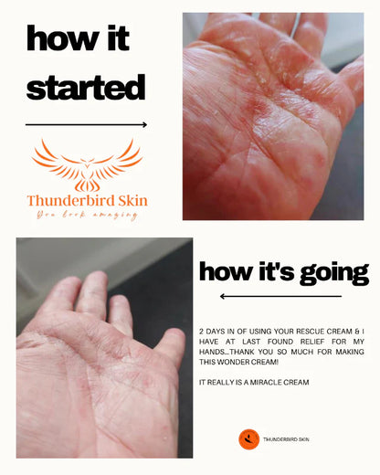 Rescue Cream comparison with adult hands 2