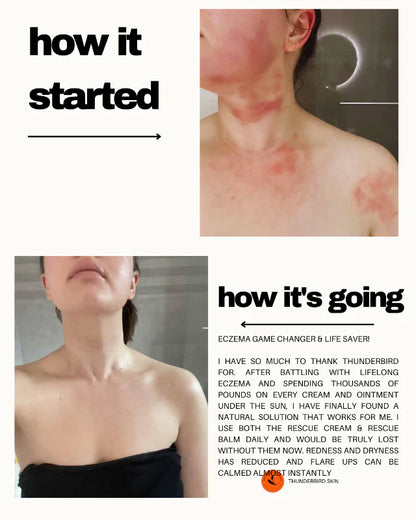 Rescue Cream young womans neck comparison