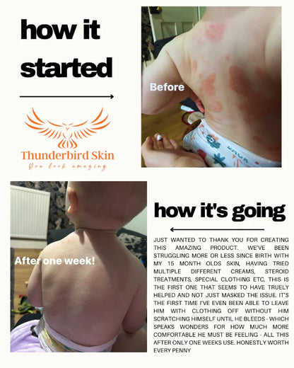 Rescue Cream lifestyle shot comparison of child's skin