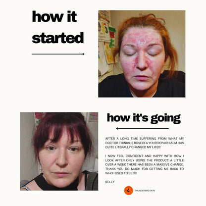 Wild Crafted Repair Balm young woman face comparison