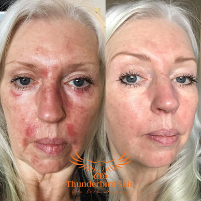 Wild Crafted Repair Balm older woman comparison