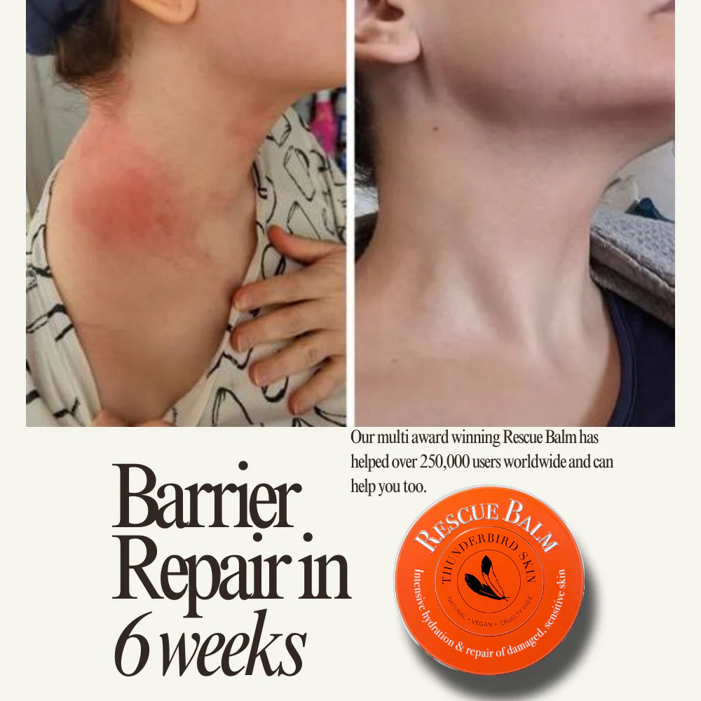 Before and after of rescue balm